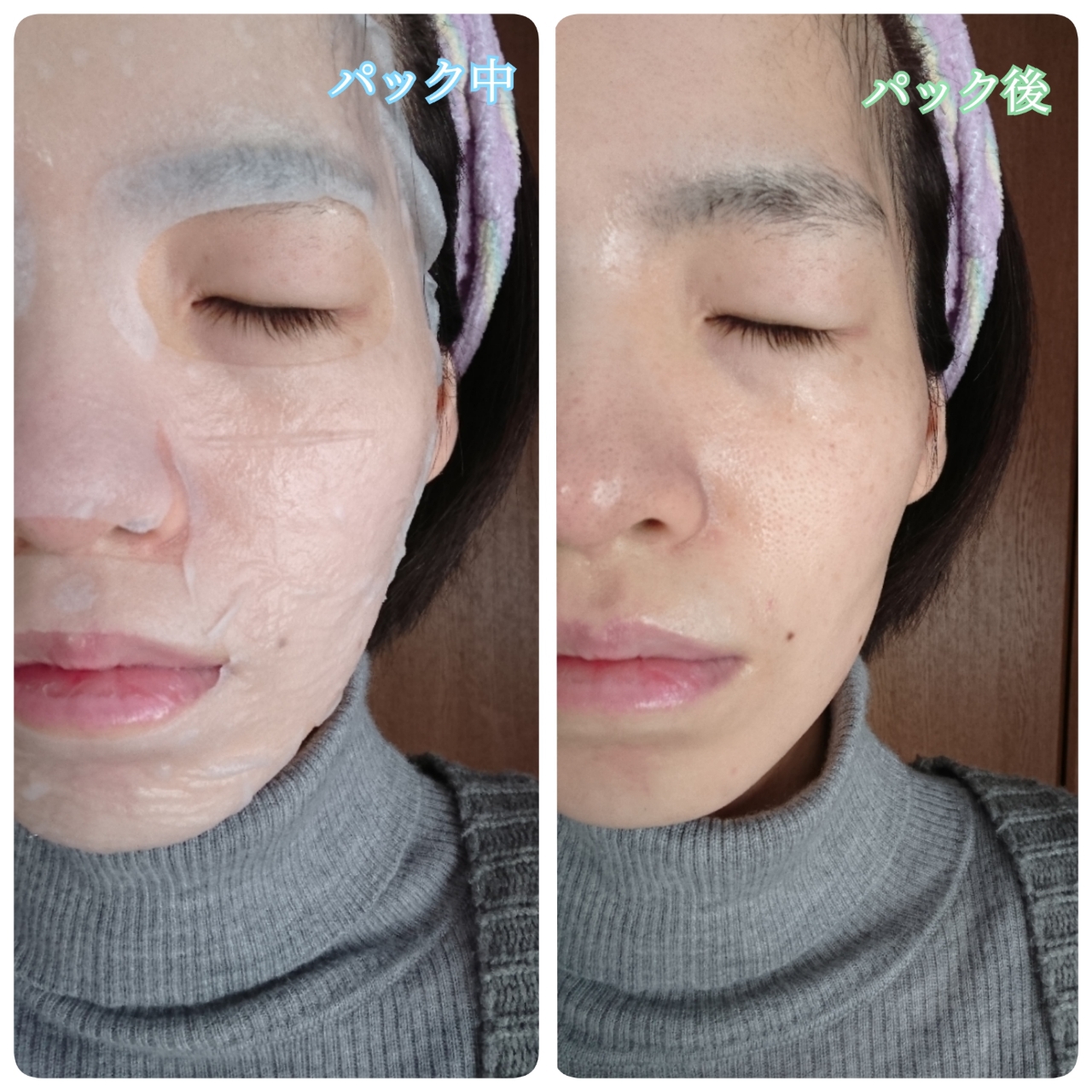 medeinme リラクゼーションマスクを使ったYuKaRi♡さんのクチコミ画像7