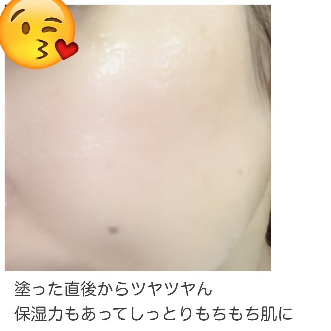 ビタ3セラムを使ったyungさんのクチコミ画像4