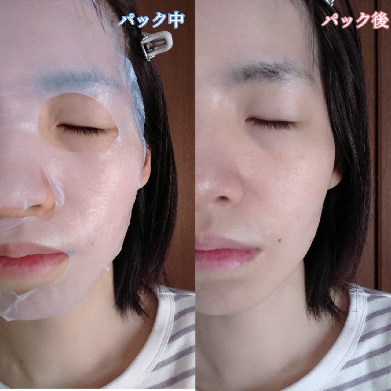 ULTIA バック エイジングケア マスクを使ったYuKaRi♡さんのクチコミ画像7