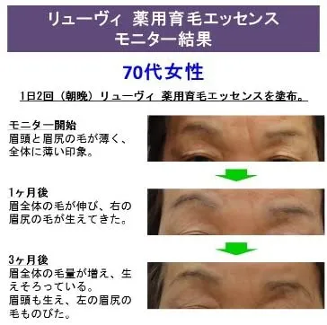 Lyuvie リューヴィ 薬用育毛エッセンスの口コミ 評判一覧 0件の眉毛育毛剤レビュー モノシル Lyuvie リューヴィ 薬用育毛エッセンスの口コミ 評判一覧 0件の眉毛育毛剤レビュー モノシル
