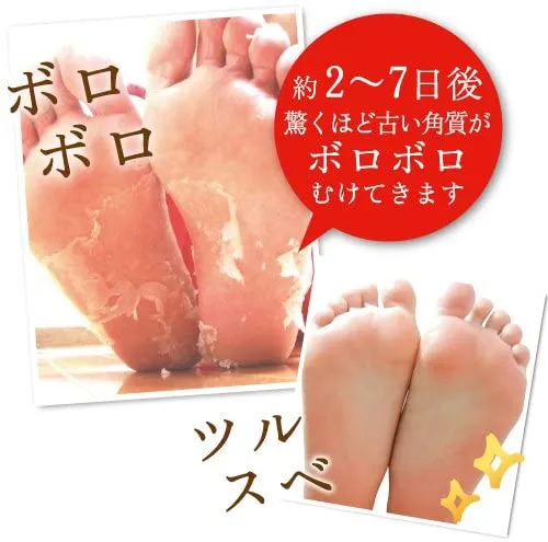 Baby Foot(ベビーフット) イージーパック SPT60分タイプの悪い口コミ